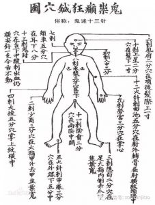 出马仙治邪病“鬼门十三针”口诀